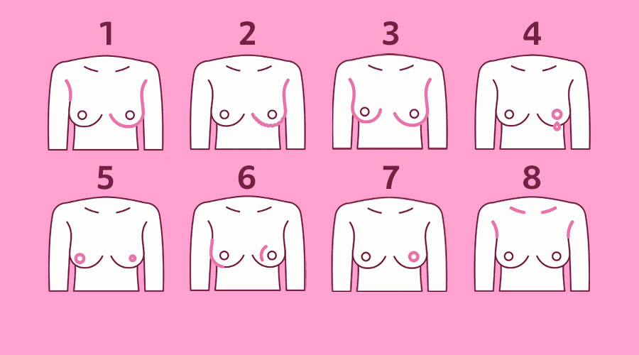 infográfico sobre Câncer de Mama: a imagem é uma ilustração com 8 possíveis sinais que podem indicar a presença da doença